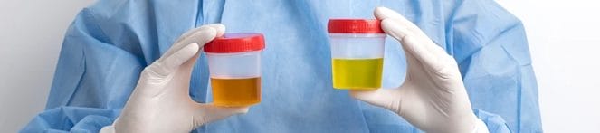 Comparing Urine Luck and Quick Fix