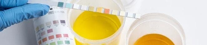 A top view of a doctor examining urine samples