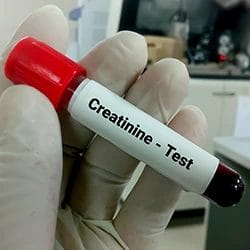 A test tube labeled creatinine