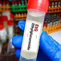 A test tube labeled as EtG