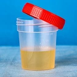 A jar of urine with a blue background