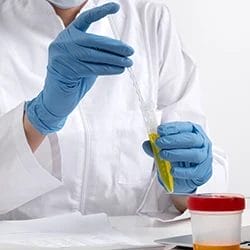 A doctor getting a urine sample from a test tube