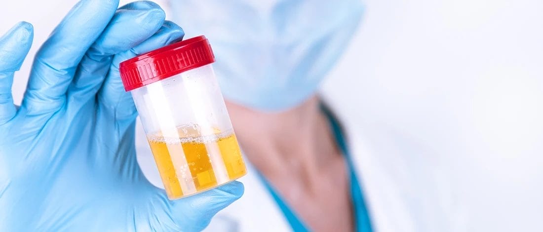 A doctor holding a bottle of urine