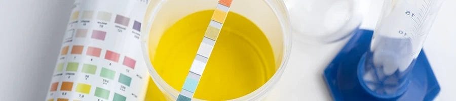 A top view of urine sample and other laboratory equipment