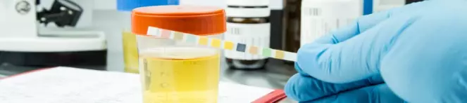 A jar of synthetic urine in a laboratory